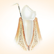 Gesundes Zahnfleisch